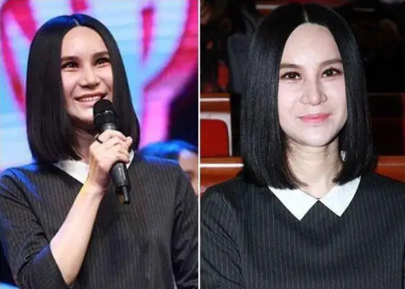 娱乐圈没整过容的明星_孙菲菲整容后无戏可拍_娱乐圈整容女明星名单